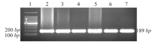 <p>Figure 1. Agarose gel electrophoresis of PCR amplified DNA fragments for genotyping of CCR5 alleles. 1: 100 <em>bp</em> DNA ladder; 2-7: wild type (CCR5/CCR5).</p>