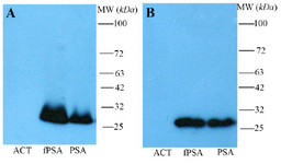 <p>Figure 2. Western blot analysis of polyclonal rabbit anti-fPSA. Non-reduced (A) and reduced (B) antichymotrypsin (ACT), fPSA and total PSA (90% PSA-ACT, 10% fPSA) proteins were subjected to SDS-PAGE, transferred to a nitrocellulose membrane and reveled with HRR conjugated rabbit anti-fPSA.</p>