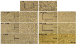 <p>Figure 5. Microscopic images of Saos cell line after 72 <em>hr</em> of treatment with different concentrations of CS extract, scale bar: 50 <em>&micro;m</em>.</p>