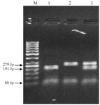 <p>Figure 1. Detection of <em>PON1</em> gene polymorphism by PCR-RFLP using <em>ALWI</em> restriction enzyme. Lane 1, fragments presenting the RR genotype for the mutant homozygous patient; lane 2, fragments indicating the QQ genotype for the wild type homozygous patient; lane 3, fragments showing genotype for heterozygous patients; M= 50 <em>bp</em> DNA marker.</p>