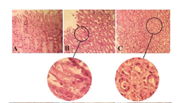 <p>Figure 2. The gastric mucosa appearance in (A) normal and (B, C) indomethacin-induced lesions stained with H&amp;E (100x magnified). Normal stomachs have intact epithelium with dis-tinct chief and parietal cells where ulcer areas show epithelium damage and infiltration of lymphocytes and monocytes.</p>