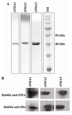 Figure 4. Analysis of the purified recombinant FHA fragments by SDS-PAGE; A) and Western blotting; C). All proteins were purified through His-tag by Ni-NTA column. SDS-PAGE analysis was performed using a 12% polyacrylamide gel followed by Coomassie blue staining. Western blot analyses of rFHA1-3 fragments were performed using two different preparations of detecting antibodies, including rabbit anti-FHA produced in our lab and a commercial rabbit anti-His tag. SM: protein size marker