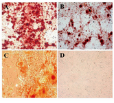 Figure 4. Osteogenic differentiation after 28 days showed marked morphological changes and extensive extracellular calcium deposition in bone marrow; A) Liver; B) and adipose tissue; C) derived MSCs as demonstrated by positive Alizarin Red S staining (200×). No mineralized nodules were apparent in non induced cell cultures; D) (200×)