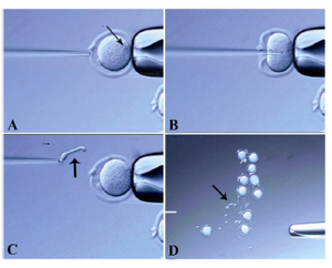 Figure 1. Oocyte enucleation. The oocyte was rotated such that the metaphase II spindle was located between the 8 and 10 o�clock positions A) Next, this oocyte was held on the holding pipette. The nucleus was removed by suction without breaking the plasma membrane. The pipette was gently pulled away from the oocyte B) and C) A group of ten oocytes follow enucleation. To verify enucleation, the nucleus was pushed out. It was felt harder than the cytoplasm D) Arrows point to nuclei