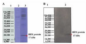 Figure 2. Expression of HBX in Hep G2 cell line by SDS PAGE and Western blot. The purified bands had a molecular size of ∼17 kDa, corresponding with the size of HBX protein; A) Hepatitis B virus X protein was separated on 12% SDS-polyacrylamide gel electrophoresis; Lane 1: Protein marker (Sigma marker, M 3913), Lane 2: Non-transfected cell (negative control), Lane 3: transfected cell; B) Expression of HBX 16.7 kDa was analyzed using Western blot by serum samples from patients with Liver Cirrhosis. Lane 1: Protein molecular weight marker (Sigma marker, M 3913), Lane 2: transfected cell with HBX