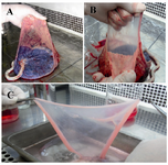 Figure 1. Separation of amniotic membrane. Placenta was placed under a biological safety cabinet with fetal side up. 
A) Membranes were extended with left hand; B) Amniotic membrane was mechanically peeled free from underlying chorion; C) Amnion was washed several times with ice-cold isotonic buffer or culture medium to remove blood and cellular debris 
