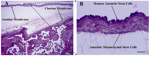 Figure 2. H&E staining of placenta section. A) Amnion and chorion membranes and intermediate spongy layer are easily distinguishable; B) As seen in this close view of the amnion layer, amniotic membrane composed of single layer of flattened cuboidal cells resting on a basement membrane.  Beneath this layer, stromal layer composed of amniotic mesenchymal cells is seen; Upright light microscope, A) scale bar; 500 µm, B) scale bar; 50 µm