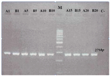 Figure 1. Gel electrophoresis to study human mitochondrial DNA (mtDNA) common deletion in adult stem cell lines (DPSCs). Marker is a 100 bp DNA ladder. The other lanes demonstrate 279 bp mtDNA amplified with primers ONP 86 and 89. No PCR amplicons were generated in any three cell lines using primers ONP 74, ONP 25, ONP 99, ONP 10 indicating no mtDNA common deletion. A1, A5, A10, A15 and A20 indicate periapical follicle stem cells (PAFSCs) after 1, 5, 10, 15 and 20 passages. B1 B5, B10, B15, B20 indicate the same results in dental pulp stem cells (DPSCs). C and M show negative control and marker, respectively 