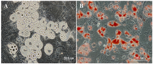 Figure 4. A) Fatty acid droplets after culture in adipogenic medium (phase-contrast image); B) Fatty acid droplets after culture in adipogenic medium (oil red staining)