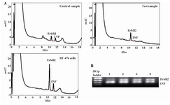 Figure 2. HPLC separation and electropherogram of The PCR products from the ErbB2 oncogene and the interferon gamma gene (INF&#947;) for the detection of the ErbB2 gene amplification. A) Chromatograms showing the results for normal DNA (control), DNA from cancerous breast (test) and BT-474 breast carcinoma cell line (high copy control); B)  Lane 1 is high copy control, lanes 2 and 3 are DNA from primary breast carcinoma and lane 4 is normal breast tissue