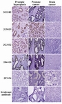 Figure 5. Assessment of anti-PSA mAb immunoreactivities in IHC. Sections of prostate cancer (PCa), benign prostatic hyperplasia (BPH) and brain cancer tissues were prepared and stained with anti-PSA mAbs (original magnification, ×20).