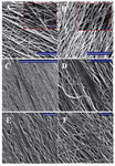 Figure 1. PLLA/PCL hybrid nanofibers, A) without gelatin coating; B) with gelatin coating; C, D) show ADSCs cultured on aligned PLLA/PCL; the orientation of cells is parallel to the scaffold fiber even after just 1 day of cell seeding. E) ADSCs on aligned PLLA/ PCL without gelatin coating; F) ADSCs on aligned PLLA/PCL with gelatin coating. Scale bars are 100 µm in main pictures and 10 µm in the small boxes (A, B), 1 mm (C) and 100 µm (D, E, F).