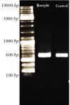 <p>Figure 3. Confirmation of ligation CHAPk in T7Select vector using PCR reaction. After electrophoresis, the PCR product and positive control were located at 600 <em>bp</em>.</p>