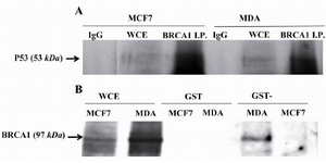 Figure 1. TP53 bound to BRCA1 in vivo and in vitro. A) In vivo binding of wild type (WT) TP53 in MCF7 cell line and mutated TP53 in MDA-MB-468 (MDA) to BRCA1. Cell lysates were immuno-precipitated with Ab against BRCA1 and IgG and then the immuno-complexes were Western blotted for anti-p53. B) Mutated TP53 did not interfere with in vitro binding of WT TP53 to BRCA1. BRCA1 was pulled down in MDA-MB-468 (MDA) and MCF7 cell lysates by GST-WT p53 that was a fusion protein synthesized in prokaryotes cells and analyzed by Western blotting with anti-BRCA1. WCE whole-cell extract, I.P. Immunoprecipitate.