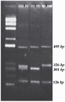 Figure 1. Multiplex PCR, first lane is a 100 bp DNA ladder. Lane 1 doesn't have any deletion. Lane 2 has sY84 deletion and lane 3 has sY134 deletion.