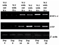 Figure 4. Expression pattern of hepatocyte-like cells speciﬁc markers. It is clear from the figure that the highest expression level for αFP was at day 14, but for HNF1-α at day 28. RA had the profound effects on expression levels of the two discussed markers. We can also see that the rates for cells at day 0 were not significant. WJ= Wharton’s jelly-mesenchymal stem cells; αFP=alpha-fetoprotein; and HNF-1α=hepatocyte nuclear factor-1α.