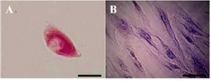 Figure 5. Periodic Acid-Schiff (PAS) staining for glycogen analysis. A) In the presence of Retinoic Acid (RA), glycogen storage in hepa-tocyte-like cells was at the high level but B) in the absence of this factor no storages was detected (Scale bar for A=30 µm, and for B=10 µm).