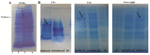 <p>Figure 6. A) SDS-PAGE analysis of recombinant Foxp3-IgG2 (Fc) with Coomassie-stained. Expression of rFoxp3-IgG2 (Fc) in <em>E coli</em> BL21 induced with 1.0 <em>mmol</em> IPTG. From left to right: Lane 1: Protein marker (Fermentase), Lane 2: Non-induced with IPTG, Lane 3: Induced with IPTG (~69 <em>kDa</em>), Lane 4: Bacterial lysate (negative control); B) the effect of the period of induction on high production level of rFoxp3- IgG2(Fc). Triplicate lanes induced with 1mM IPTG (showed by arrows), uninduced and protein marker at time course of induction 3 <em>hr</em>, 5 <em>hr</em> and overnight, respectively.</p>