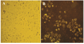 <p>Figure 8. Bright field image of HeLa cancer cells incubated with GNPs. A) Dark-field image of a live cell after treatment (&sim;48 <em>hr</em>) with GNPs in cancer cells; B) Cell surface scatters yellow light due to the GNPs uptake in the visible region.</p>