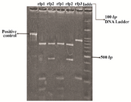 <p>Figure 1. Restriction fragment pattern (rfp) of <em>hmw1A</em> gene fragment amplified by PCR. RFLP patterns were obtained after digestion of PCR products with Taq1. Number 0, PCR products of <em>hmw1A</em> gene without restriction enzyme; numbers 1-3, digestion products of <em>hmwA </em>gene fragments amplified (three different patterns); the last lane, <em>molecular weight marker.</em></p>