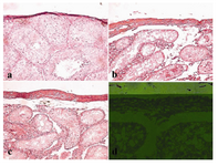 Figure 4. Histological examination of capsular thickness of mouse testes following busulfan treatment
(a) Capsular thickness in normal testis (control), (b) 
15 mg/kg busulfan treated testis, (c) 30 mg/kg busulfan treated testis, and (d) 45 mg/kg busulfan treated testis. The results showed that testis capsular thickness was increased after busulfan treatment in a dose-dependent manner. Magnification: × 20 (in a, b, and c) and × 40 (in d)
