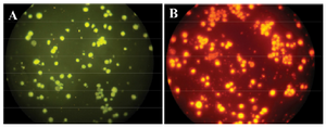 <p>Figure 4. FISH test. NB4 cells with PML-RARa FRET probes in green (A) and red channel (B).</p>
