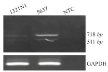 <p>Figure 2. A) RT-PCR analysis of OCT4B3. Using primer set B2S/RB2 we detected a 511 bp PCR product in the 5637 and 1321 cell lines which was corresponded to the OCT4B3 transcript. The 718<em> bp</em> fragment was considered to be the OCT4B2 variant. GAPDH was used as internal control for RT-PCR and NTC is non-template control.</p>