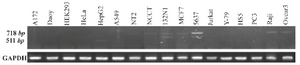 <p>Figure 4. Expression pattern analysis of OCT4B3 by RT-PCR. Using primer set B2S/RB2, the expression pattern of OCT4B3 was investigated in various human cell lines. 718<em> bp</em> and 511<em> bp</em> PCR products considered to be OCT4B2 and OCT4B3, respectively. Among 17 cell lines, OCT4B3 was detected just in 1321N1 and 5637 cell lines. GAPDH was used as internal control of RT-PCR with the size of 140<em> bp.</em></p>