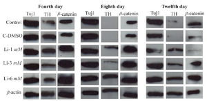 <p>Figure 5. Western analysis of differentiated cells in different concentrations of LiCL for TH, Tuj1 and &beta;-catenin markers in 4, 8 and 12 days.&nbsp; &beta;-actin was used as a control marker.</p>
<p>&nbsp;</p>