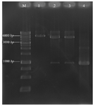 <p>Figure 1. Agarose gel electrophoresis analysis of recombinant pET28a/<em>pilQ</em><sub>1138-2118</sub> with restriction enzyme digestion. Lane M; DNA marker (1 <em>kb</em>), Lane 1; mono-digestion of the pET28a/<em>pilQ</em><sub>1138-2118 </sub>vector with BamHI. One expected fragment was observed on the gel (~6350 <em>bp</em> band). Lane 2 and 3; BamHI/HindIII double digested the recombinant vector with BamHI and HindIII buffer, respectively. Two expected fragments from double digestion were observed on the gel (~5369 and 981 <em>bp</em> bands). Lane 4; the optimized PCR product of the <em>pilQ</em><sub>1138-2118</sub> gene (~ 961 <em>bp</em> band).</p>
