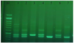 <p>Figure 2. Gel electrophoresis stained with green viewer.</p>