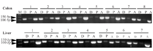 <p>Figure 1. Agarose gel electrophoresis of RT-PCR products of <em>DNMT3b</em>, <em>PPAR</em><em>&alpha;</em> and <em>&beta;</em><em>-actin</em> gene in the colon and liver tissues of rats. The presence of PCR products with the expected lengths of about 107 <em>bp</em> for <em>DNMT3b</em>, 106 <em>bp</em> for <em>PPAR</em><em>&alpha;</em> and 102 <em>bp</em> for <em>&beta;</em><em>-actin</em> was conﬁrmed. M, DNA marker; D, <em>DNMT3b</em>; P, <em>PPAR</em><em>&alpha;</em>; A: <em>&beta;</em><em>-actin</em>.</p>