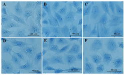 <p>Figure 1. The effects of different doses of <em>Anethum graveolens L.</em> (dill) seed aqueous extract on chromatin condensation of cultured granulosa cells, aniline blue staining, scale bar=40 <em>&micro;m</em>. A) Control culture, B) 10 <em>&mu;g/ml</em>, C) 50 <em>&mu;g/ml</em>, D) 100 <em>&mu;g/ml</em>, E) 500 <em>&mu;g/ml</em> and F) 1000 <em>&mu;g/ml</em> of <em>Anethum graveolens L.</em> extract treated culture.</p>