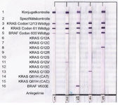 <p>Figure 1. Nitrocellulose strips from reverse dot blotting. Results from right: G12D mutation, G13D mutation, V600E mutation, G12V mutation, no mutation in both oncogenes.</p>