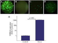 <p>Figure 1. Tumor specificity of Green Fluorescent Protein (<em>GFP</em>) expression under Sur-P control. <em>GFP</em> was expressed in the LX-2 cells transfected with pAdenoVator-CMV-NDRG2-IRES-GFP (A), but not in those transfected with pAdenoVator-Sur-P-NDRG2-IRES-GFP(B). <em>GFP</em> was also expressed in the A549 cells transfected with both pAdenoVator-CMV-NDRG2-IRES-GFP (C) and pAdenoVator-Sur-P-NDRG2-IRES-GFP (D). Real-time PCR data (E) of <em>NDRG2</em> expression in the A549 cells transfected with the pAdenoVator-Sur-P-NDRG2-IRES-GFP plasmid and control non-transfected cells. The data represent the mean&plusmn;SD of at least three independent experiments.</p>

