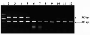 Figure 1. Representative expression profile of ROR1 mRNA in peripheral blood (PB) or bone marrow (BM) samples of a number of patients and healthy subjects. PCR amplicons of ROR1 (545 bp) and β-actin (321 bp) genes were electrophoresed on 1.5% ethidium bromide- stained gel and photographed. Lane 1: size marker; Lanes 2-5: CLL (PB); Lanes 6-9: AML (6 and 8: PB and 7 and 9: BM); Lanes 10-12: healthy subjects (PB)
