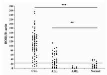 Figure 2. Relative expression levels of ROR1 mRNA in CLL, ALL and AML patients and normal subjects. The horizontal line denotes the cutoff value obtained from the normal samples; the data of ALL patients has been taken from ref 17. Relative expression of ROR1 mRNA levels in samples was determined by calculation of the ratio of ROR1 PCR product band density to that of β-actin. Baseline level of ROR1 expression was assigned as mean + 1SD of ROR1/ β-actin ratio of normal subjects.
*** :  p-values of less than 0.0001
** : p-values of less than 0.005
