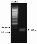 Figure 1. PCR amplification of GRA5. A pair of specific primer was designed and used to amplify GRA5 gene from genome of T.gondii RH strain. PCR product was analyzed by 1% gel agarose electrophoresis
