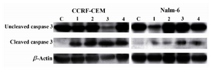 Figure 6. Effects of bryostatin-1 (Lane 2), 1α,25(OH)2D3 (Lane 3), and 4-HPR (Lane 4) on activation of caspase-3 (cleaved form) in CCRF-CEM and Nalm-6 cell lines 24 hr post treatment. C: negative control; Lane 1: positive con-trol representing ALL cells treated with Staurosporine. 
β-actin: loading control
