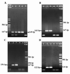 Figure 1. The agarose gel electrophoresis result of ACTB (A), SRY (B), DYS14 (C) and DAZ (D) amplification by nested PCR analysis in fetal DNA samples extracted from the maternal plasma. Lanes 1 & 2: Fetal DNA, Lane 3: Male DNA as a positive control, Lane 4: non pregnant women DNA as a negative control and Lane 5: PCR reaction negative Control (Water). A) 149 bp Positive bands in lane 1 and 2 indicate the presence of sufficient DNA in the extracted samples. Observation of positive bands 143 bp B) 122 bp C) and 156 bp D) in lane 2 shows the amplification of the relevant genes and indicate that the gender of the fetus is male. The absence of positive band in lane 1 indicates the female gender of the fetus