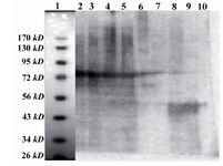Figure 2. Western Blot of fusion GST-SK expression in E.coli, BL21 PLYsS: Lane 1: Protein MW marker (Fer-mentas SM0671). Lanes 2, 3, 4, 5 and 6:  Cloned GST-SK in E.coli, after induction. Lane 7:  BSA. Lanes 8, 9 and 10: Pure SK