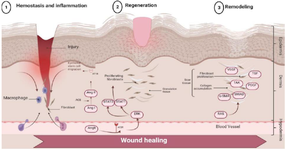 <p>Figure 1. The impact of the renin-angiotensin system on the process of wound healing.</p>