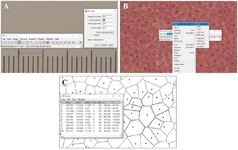 <p>Figure 2. The Voronoi tesselation tutorial. Set scale button (A), Image button (B), and figure C shows how to measure the area, mean, and SD of each polygon.</p>