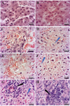 <p>Figure 5. The effects of ZnO NPs on the histological features of rabbit liver. A) Control, B) Vehicle, C) Low Dose, D, E) Medium Dose, F-H) High Dose groups: The White arrows represent vascular blood congestion. The blue arrow shows ballooned hepatocytes. The black arrow indicates the focal area. Small groups of hepatocytes are degenerating and the area is mildly infiltrated by inflammatory cells. Magnification 100&times;.</p>