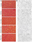 <p>Figure 6. The Voronoi tessellation results. Representative photograph of polygon area (A), schematic images of Voronoi tessellation of the hepatocytes (B), H &amp; E staining, 40&times;</p>