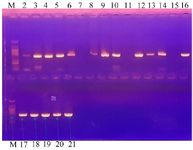 <p>Figure 2. Agar-gel electrophoresis result of the PCR amplification of the 16S rRNA of the bioactive isolates. Size of DNA marker used = 394 <em>bp</em>.</p>