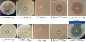 <p>Figure 3. Inhibition zones of the different treatment.</p>
<p>CTX: Cefotaxime; E_MeOH: Methanol extract; E_DCM: Dichloromethane extract.</p>
