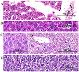 <p>Figure 7. Histopathological evaluation of hepatic tissues belong to groups A to E after injections showed no toxic effects: A) PBS, B) ABOR protein+chitin, C) RB51 Vaccine, D) Chitin, and E) ABOR protein (H&amp; E, Bar= 100 <em>&mu;m</em>).</p>